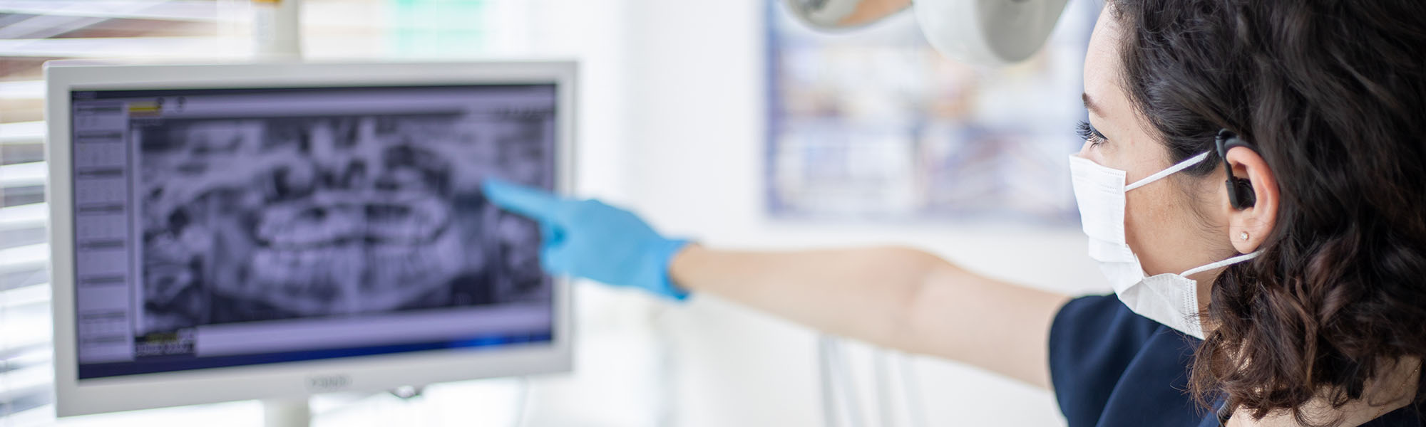 Digital Dental X-rays Oxnard CA