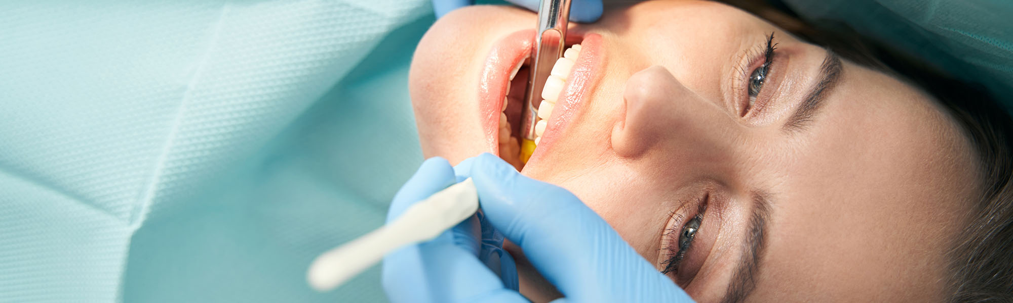 Oral Surgery Overview