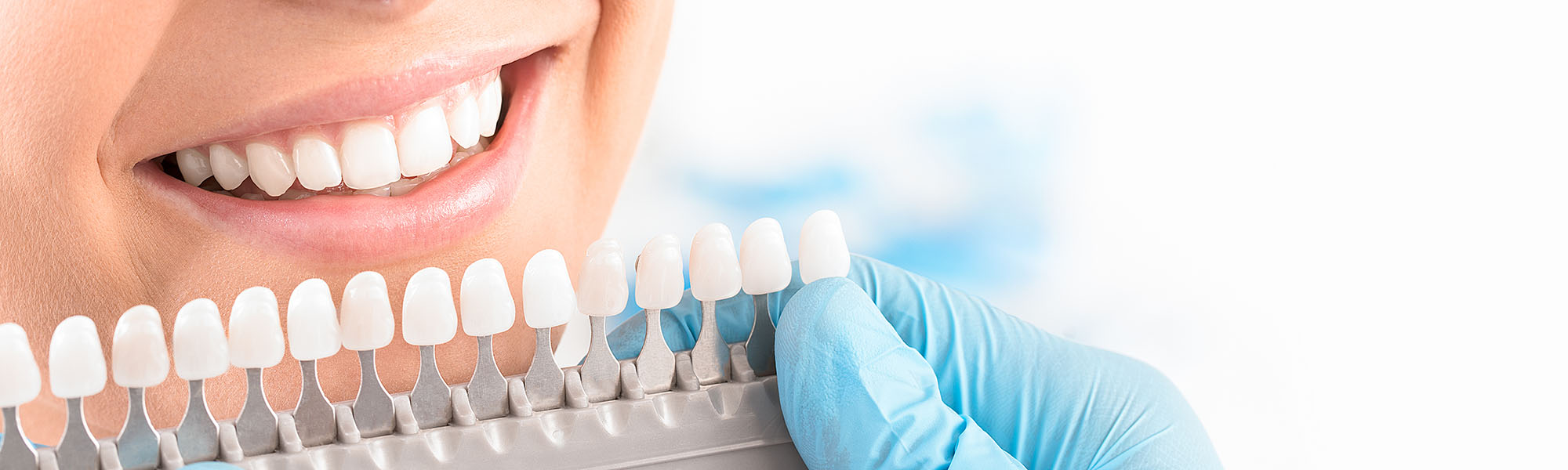Porcelain Veneers See Me Smile Dental Oxnard CA
