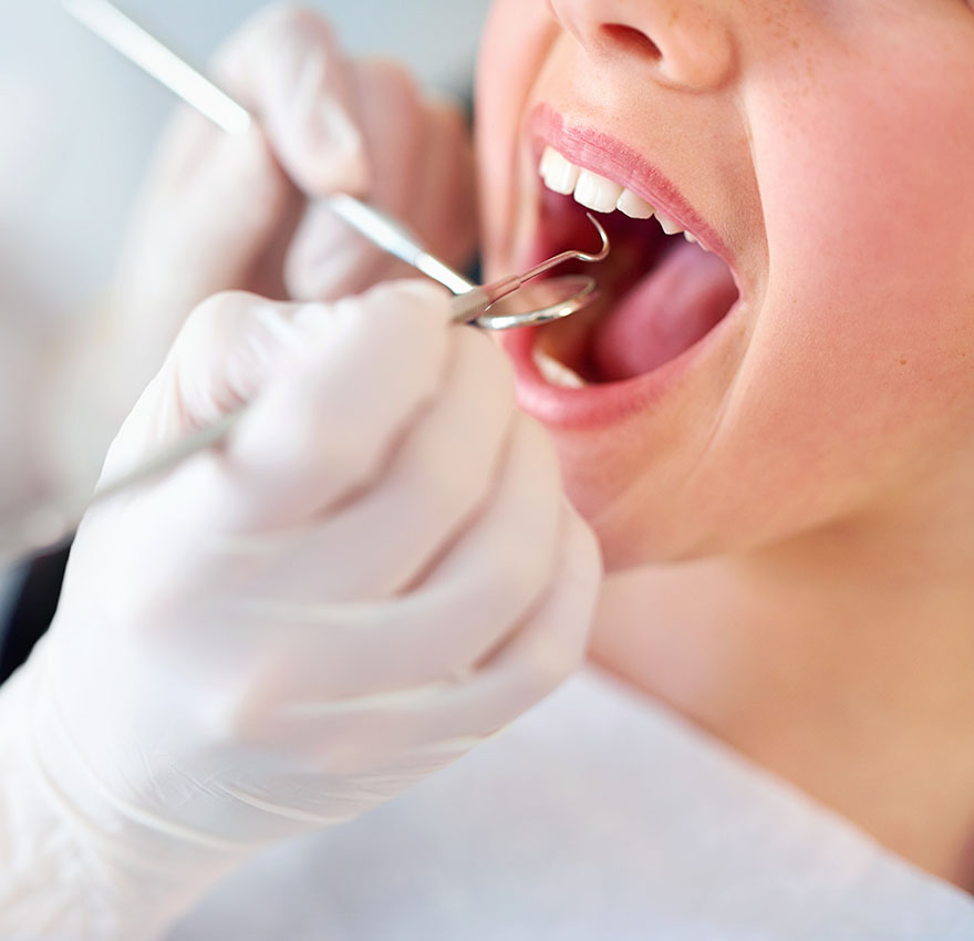 Necessary Preventative Care See Me Smile Dental Oxnard CA Imag
