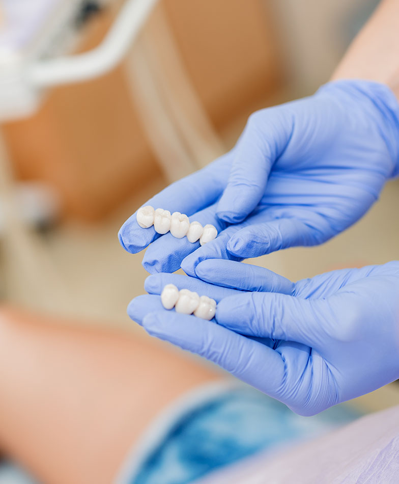 What Is the Process for Getting a Dental Crown See Me Smile Dental Oxnard CA Image.