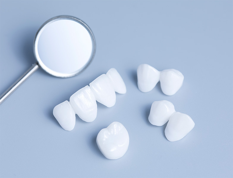What Is a Dental Crown See Me Smile Dental Oxnard CA Image.