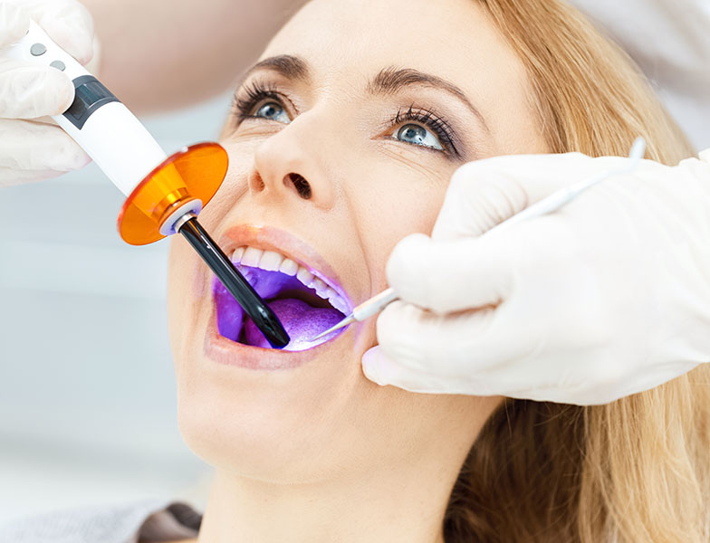 What Are Dental Sealants See Me Smile Dental Oxnard CA Image.