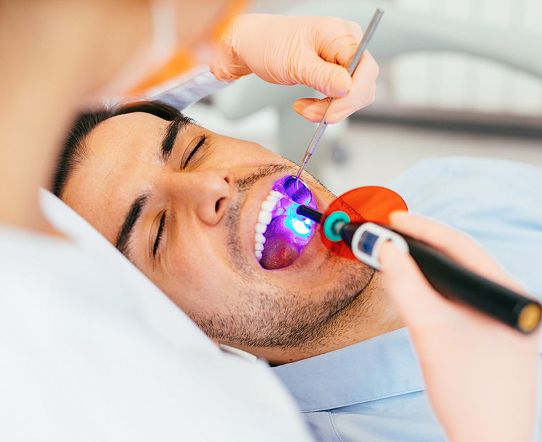 What Are Dental Sealants Used For See Me Smile Dental Oxnard CA Image.