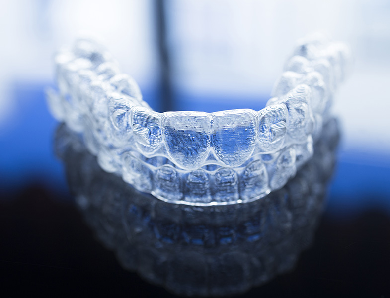 How Can I Tell if My Child Is Wearing His or Her Invisalign® Clear Braces Enough See Me Smile Dental Oxnard CA