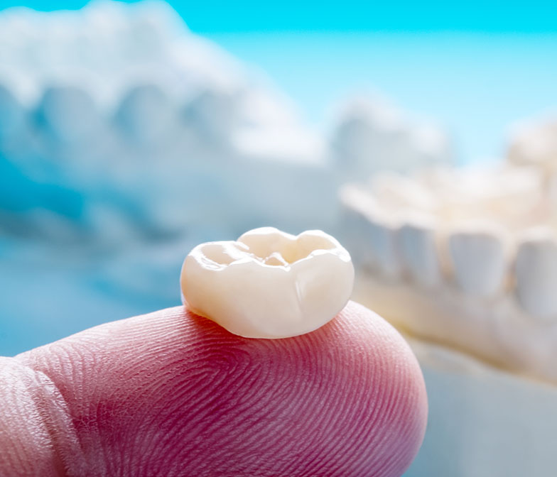 Porcelain Crowns in Oxnard vs. Inlays and Onlays: What’s the Difference See Me Smile Dental Oxnard CA