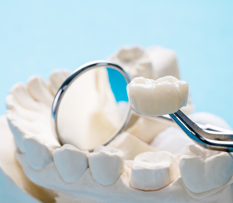 What Are Porcelain Crowns See Me Smile Dental Oxnard CA