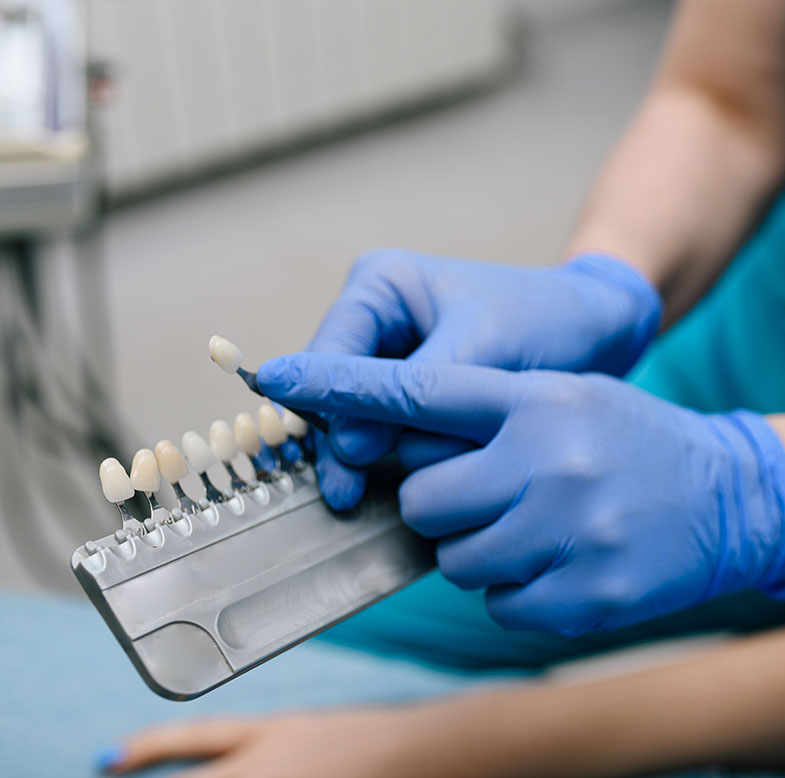 Porcelain Veneer FAQs: Your Oxnard Dentist Answers Your Questions See Me Smile Dental in Oxnard CA