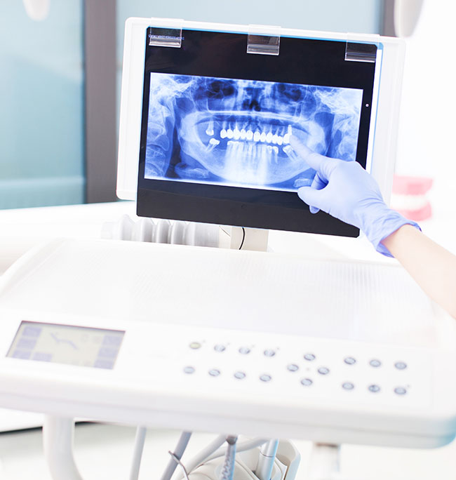 Dental X-rays Oxnard CA