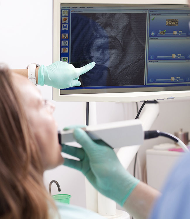 What’s an Intraoral Scanner Image