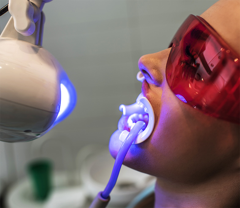 What Is Teeth Whitening See Me Smile Dental in Oxnard CA