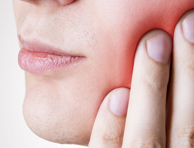Moderate Periodontitis See Me Smile Dental Oxnard CA